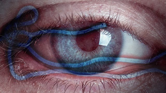 Ebola found in US man’s eye – report