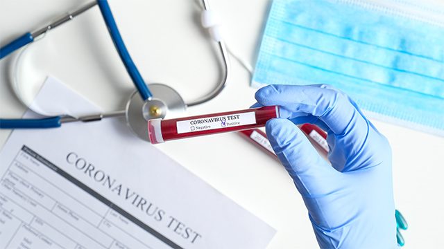 DOH tasked to set guidelines on use of coronavirus rapid test kits