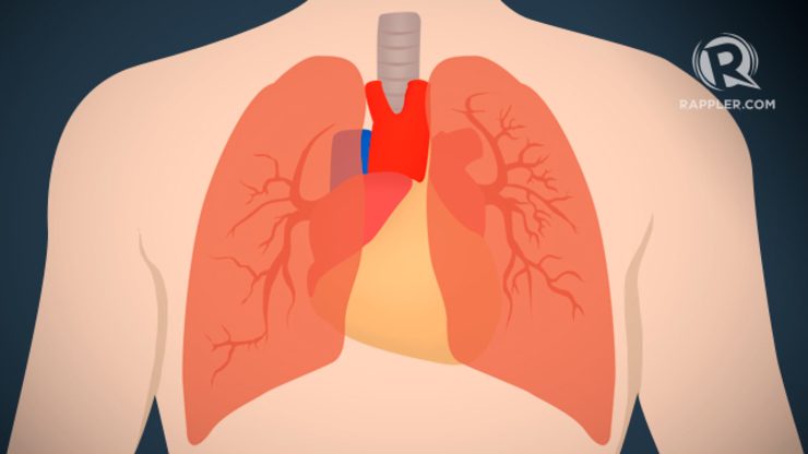 What you should know about lung cancer