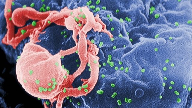 Global study finds early treatment is effective against HIV