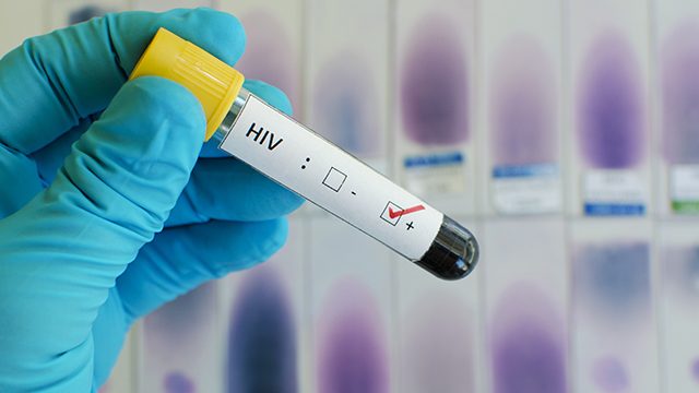 7.2 million HIV-positive in South Africa, says study