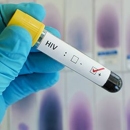 IN NUMBERS: Global HIV/AIDS cases still on the rise
