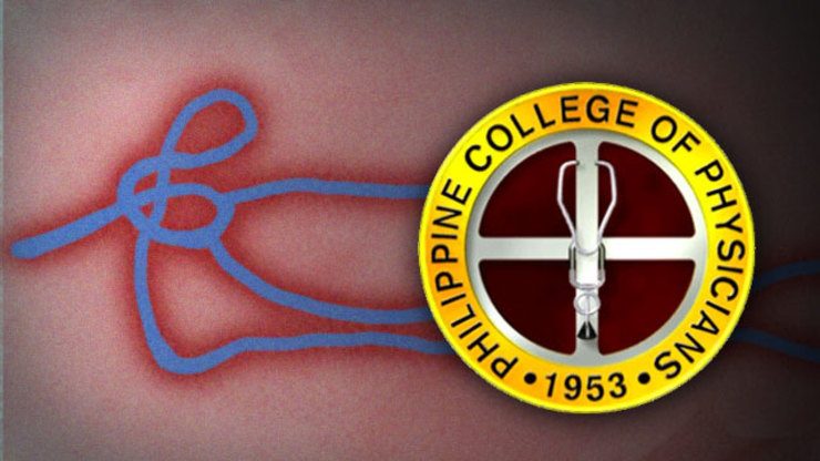 Strengthen PH defense vs Ebola first – doctors’ group