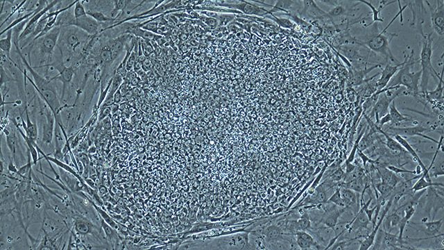 Cloning: Scientists make insulin-producing cells