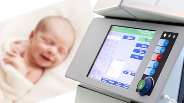World-first dialysis machine for infants is born
