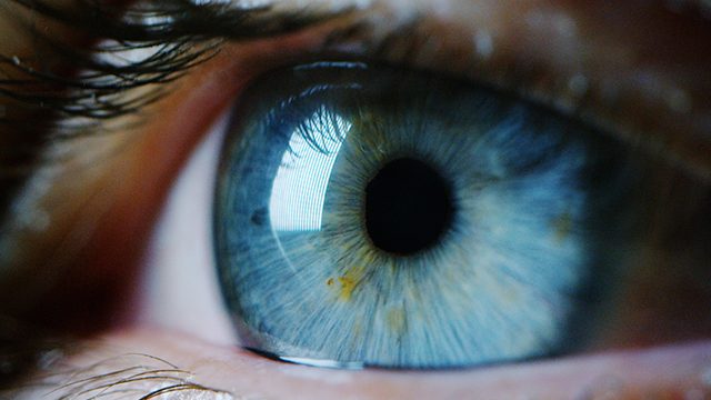U.S. approves artificial-intelligence device for diabetic eye problems