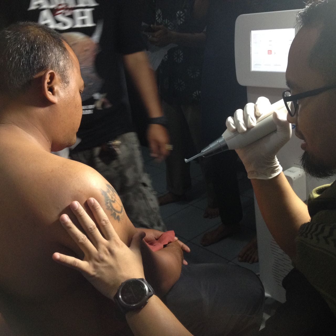 Alex Iskandar, asal Lampung, menjalani proses hapus tato dengan metode sinar laser dalam program penghapusan tato, Sabtu (12/8). Foto oleh Yuli Saputra/Rappler 