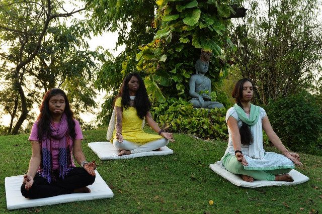 YOGA LOVE. In this photograph taken on June 14, 2015, Indian acid attack survivors, 20 year-old, Rupa (L), 26 year-old, Laxmi (C) and 30 year-old, Sonia attend a yoga class ahead of International Yoga Day in New Delhi. AFP PHOTO/Chandan KHANNA 