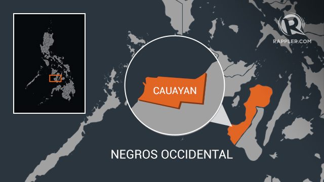 Negros Occidental mayor dies from liver ailment