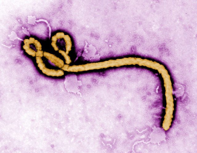 EBOLA. An undated handout image provided by the United States Centers for Disease Control and Prevention (CDC) on 05 August 2014 shows a colorized transmission electron micrograph (TEM) of an Ebola virus virion. Frederick A. Murphy/EPA