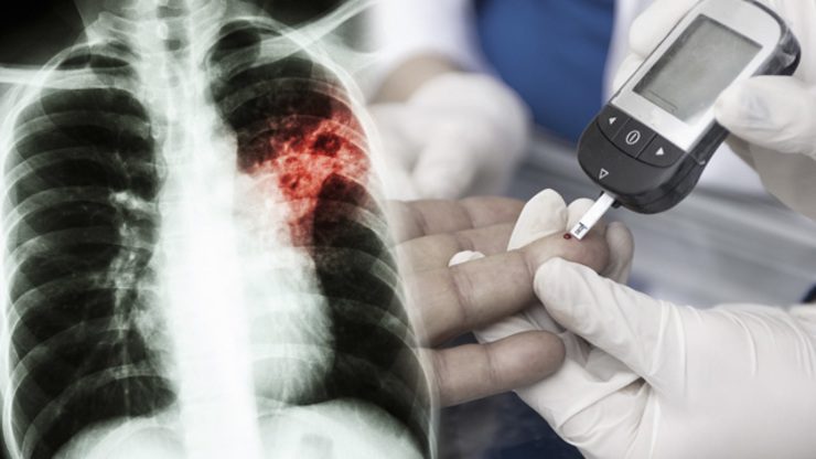 Unhealthy lifestyles causing TB-diabetes epidemic