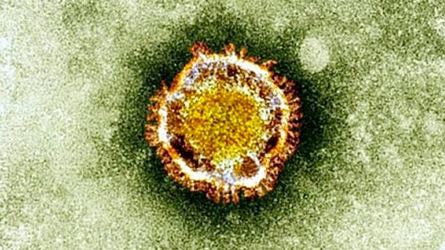 Deadly Middle East respiratory virus strikes in US