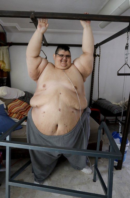 500 POUNDS LESS. Mexican Juan Pedro Franco, the heaviest man in the world according to the Guinness World Records in 2017 with a weight of 595 kilograms, stands by his bed at his house in Guadalajara, Jalisco state, Mexico on February 17, 2018.
Photo by Ulises Ruiz/AFP 