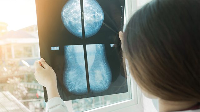 AI beats human breast cancer diagnosis