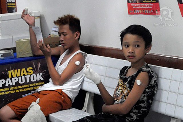 DOH: 141 fireworks-related injuries ahead of the New Year