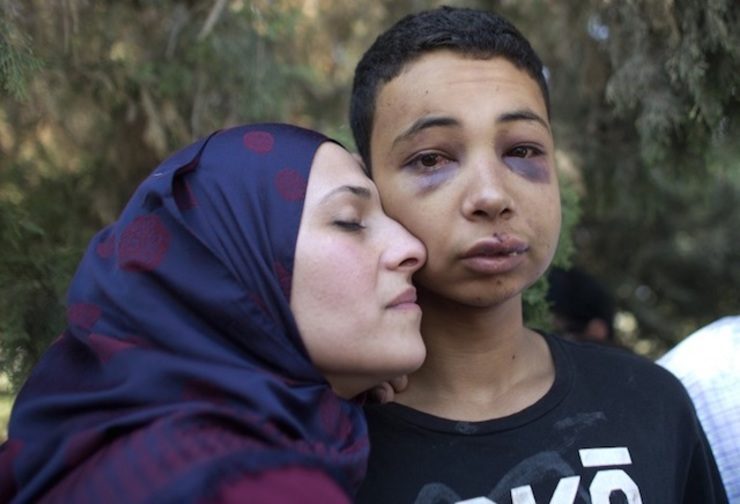 VICTIM? Tariq Abu Khder (R), a Palestinian-US teenager who was allegedly beaten during police custody, is hugged by his mother (L) following a hearing at Jerusalem Magistrates Court on July 6, 2014. Ahmad Garabli/AFP