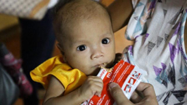 Malnutrition still prevalent in Mimaropa – UNICEF
