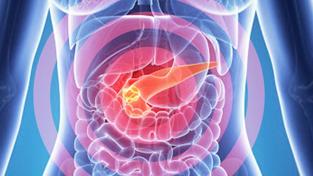 2-drug regimen shows promise against pancreatic cancer