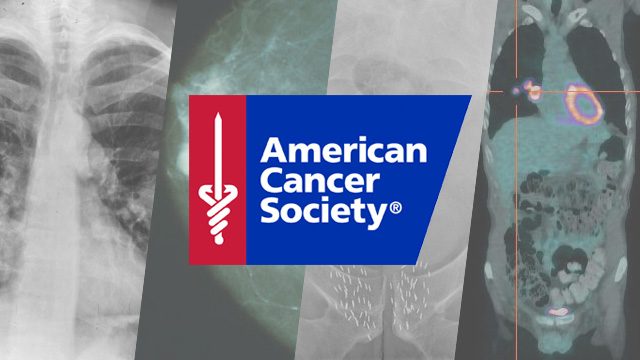 U.S. cancer death rate drops 25% since 1991