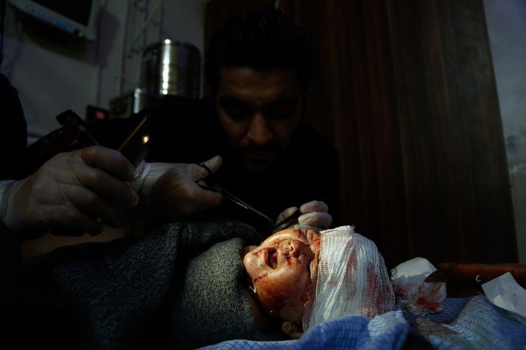 CASUALTY. A Syrian child who was injured in the bombardment of Misraba town receives treatment in a makeshift hospital in the besieged rebel-held town of Douma on January 3, 2018. Photo by Hasan Mohamed/AFP   