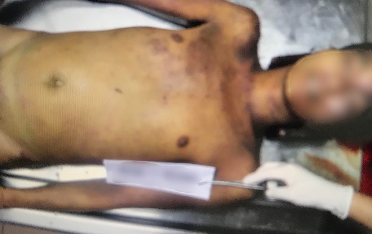 EXCLUSIVE: Photos, death certificate show Genesis ‘Tisoy’ Argoncillo beaten to death