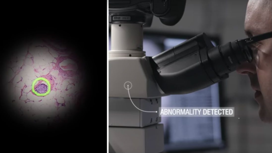 Google developing AI microscope that detects cancer cells in real-time