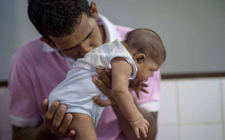 Zika babies can develop microcephaly in first year
