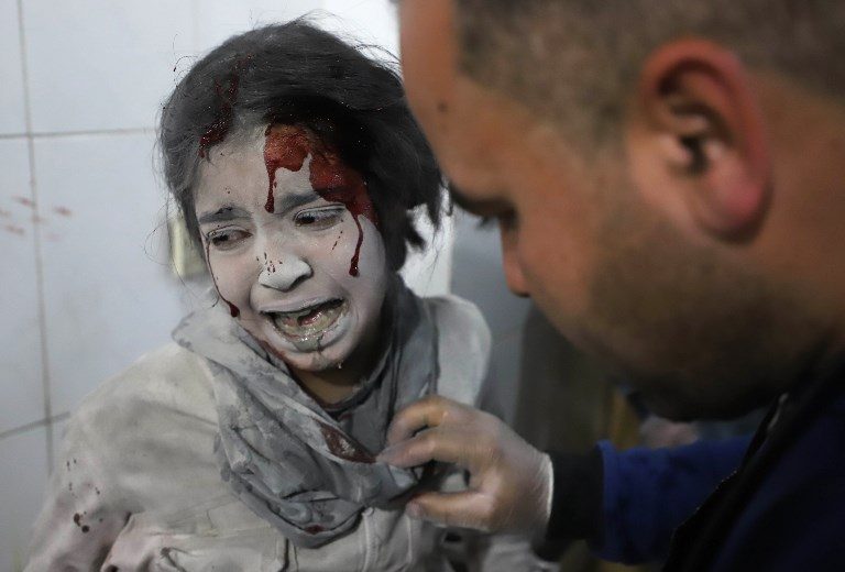 CHILDREN OF CONFLICT. A Syrian child receives treatment as victims of reported regime air strikes on Hamouria, Saqba, and Kafr Batna are brought to a makeshift hospital in the rebel-held enclave of Eastern Ghouta on March 7, 2018. Photo by Amer Almohibany/AFP   