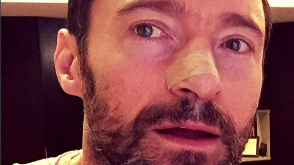 After cancer removed, Hugh Jackman warns people to use sunscreen