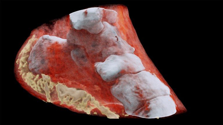 Scientists perform first-ever color X-ray on a human
