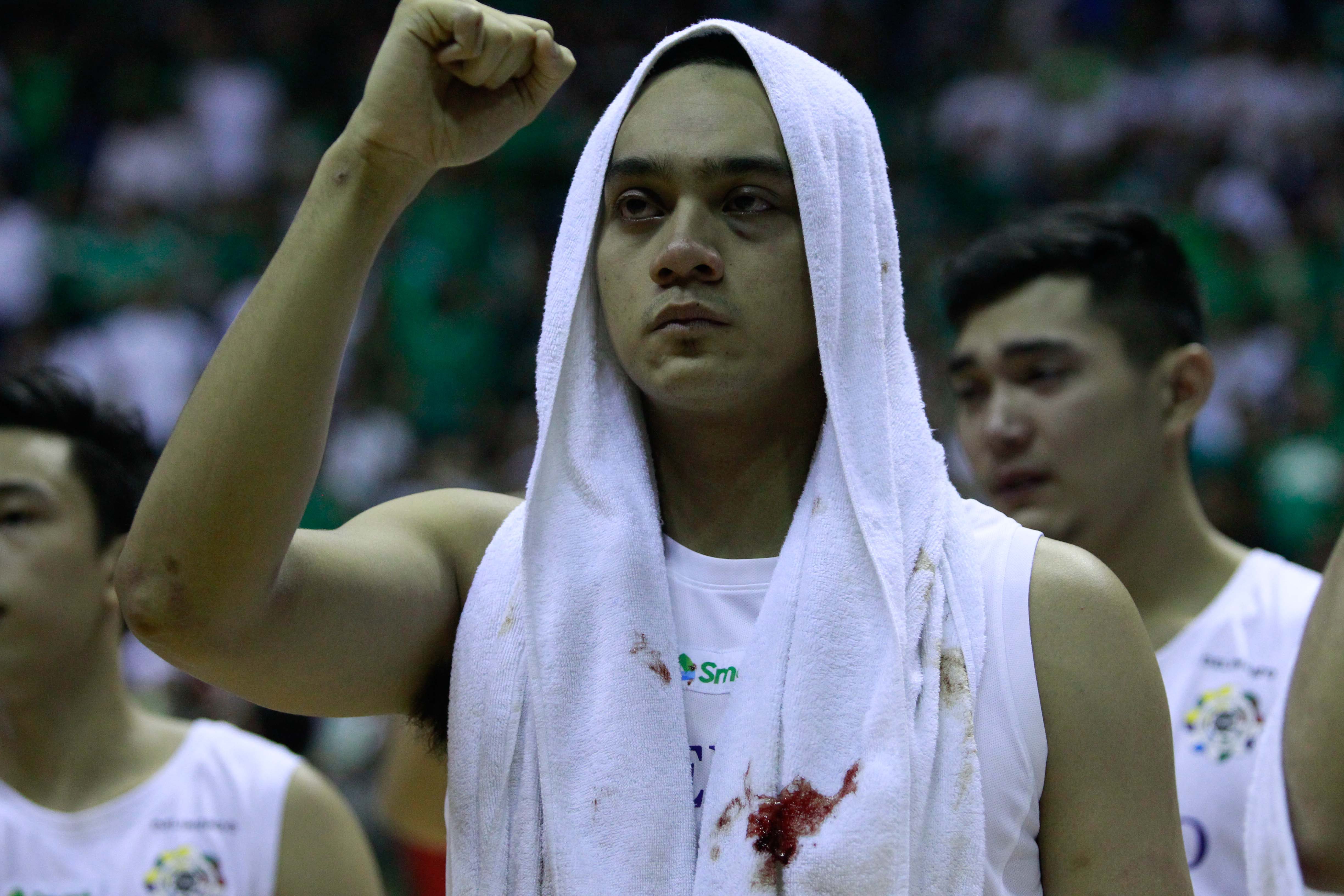 BLOODIED. A forlorn Vince Tolentino sings his school hymn, his bloodied towel seen after he got hit by an inadvertent elbow by Ben Mbala early in the game. Photo by Eduardo Solo/Rappler 