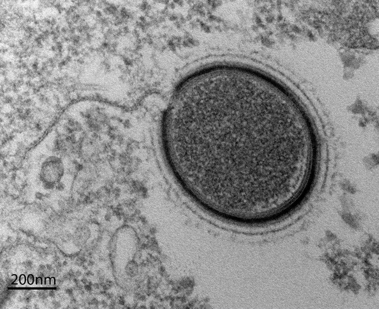 Frankenvirus emerges from Siberia’s frozen wasteland