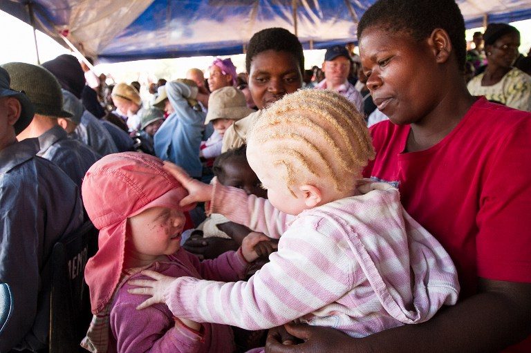 Malawi albinos targeted in ‘unprecedented’ killing wave – watchdog