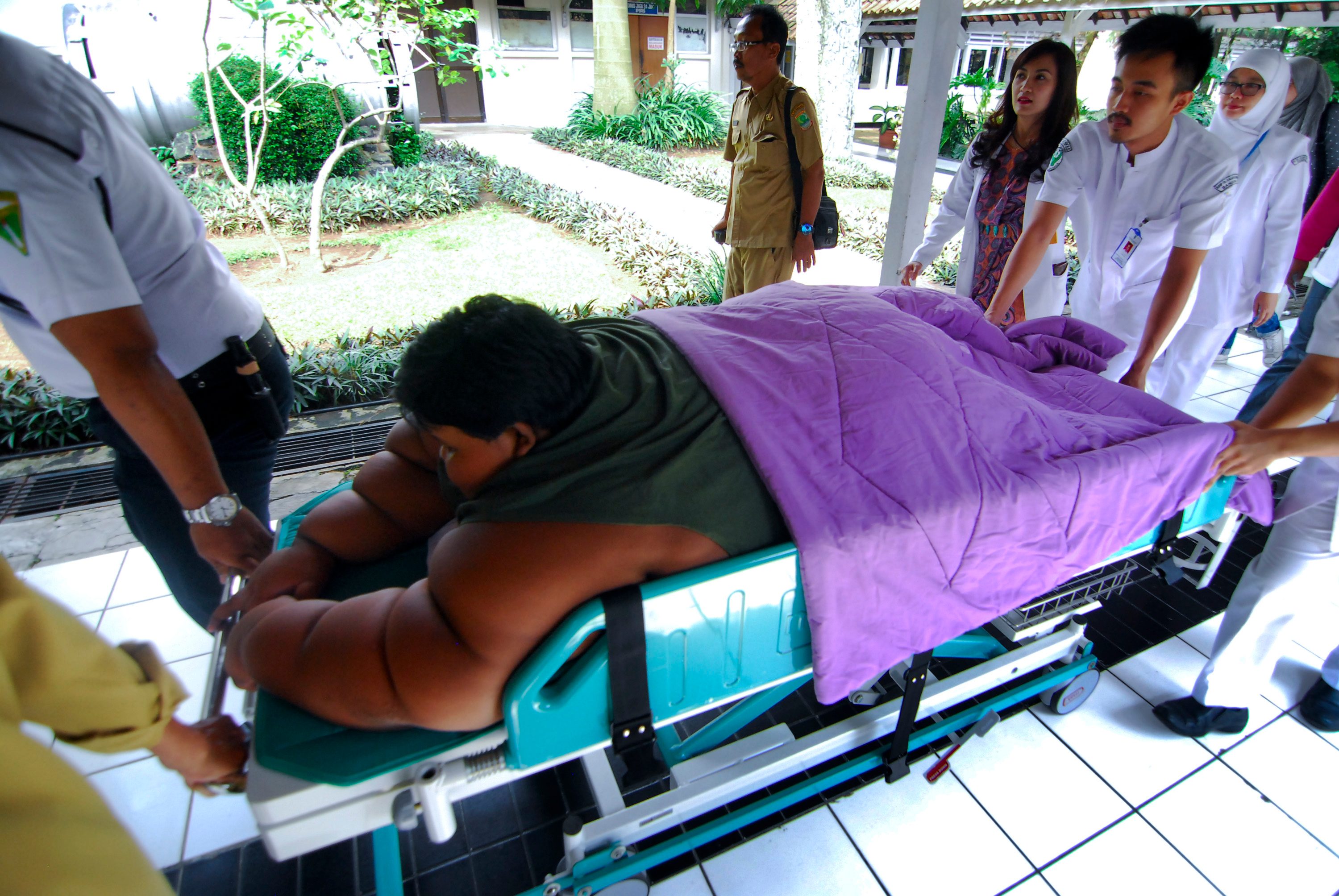 Sejumlah tim dokter membawa Arya Permana (10 tahun), anak dengan obesitas 190 kg untuk dirawat di Rumah Sakit Hasan Sadikin, Bandung, Jawa Barat, pada 11 Juli 2016. Foto oleh Novrian Arbi/Antara 