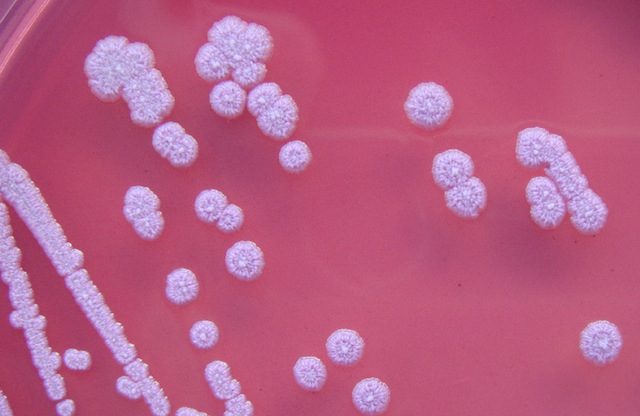 Deadly bacteria released from US high-security lab