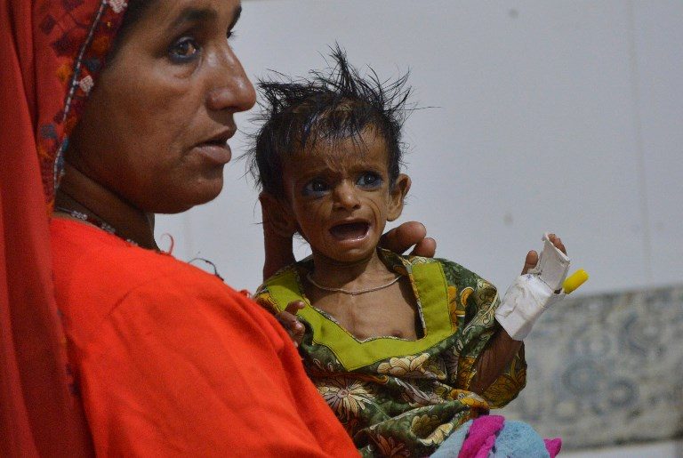 Millions malnourished in Pakistan despite abundance of food