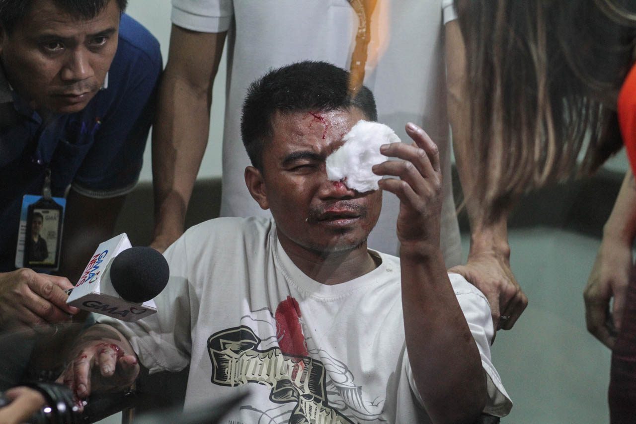 HIT IN THE EYE. A man is interviewed by the media after he gets treatment for a firecracker-related injury at the Jose Reyes Memorial Medical Center in Manila following the New Year's Eve festivities. Photo by Lito Borras/Rappler 