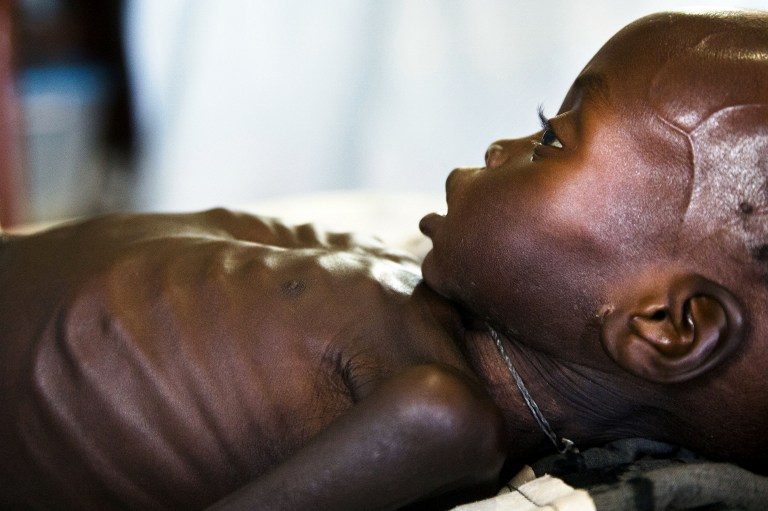 1.4 million children face famine in 4 countries – UNICEF