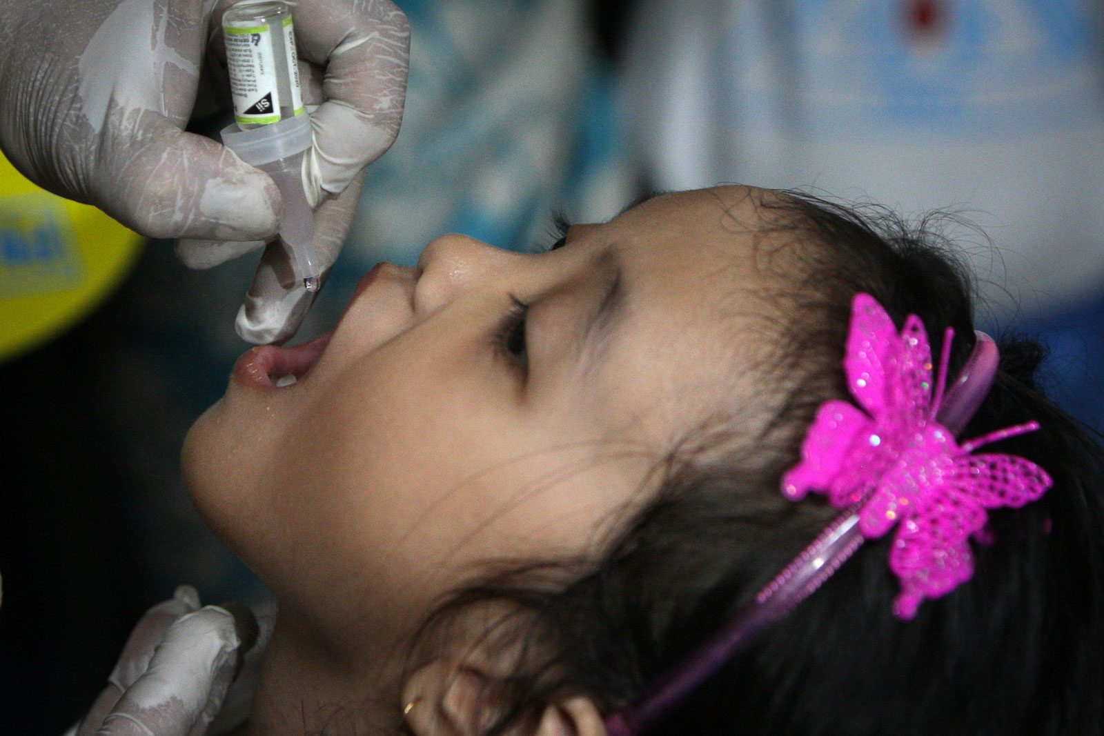 DOH confirms Philippines’ 8th case of polio in Basilan