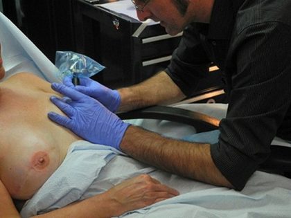 TATTOO. In his shop in Finksburg, Maryland Vincent "Vinnie" Myers specialises in tattooing nipples and areolas onto women who have undergone breast cancer surgery. Photo from AFP
